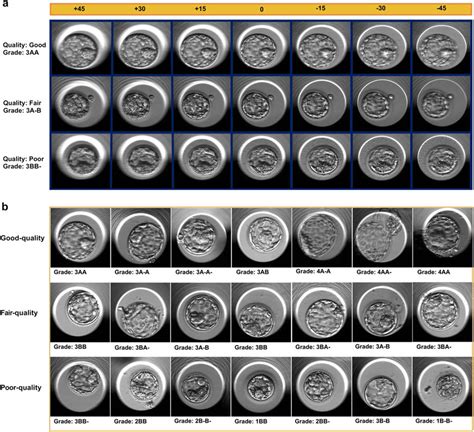 Embryologists' evaluation: a This figure shows three examples of Veeck... | Download Scientific ...