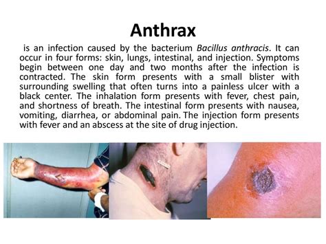 Microbiological diagnostics of anthrax, ricketsiosis and legionellosis ...