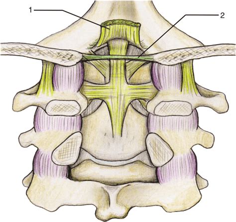 Spinal Ligaments | Musculoskeletal Key