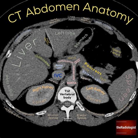 Read on for tips I use when looking at an abdominal CT...⁣ ⁣ 👨🏽‍💻I feel boring saying it again ...