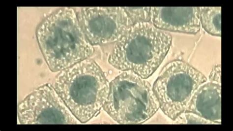 Mitosis Prophase Microscope