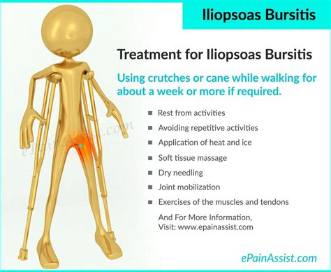 Iliopsoas Bursitis: Treatment, Exercise, Causes, Symptoms, Risk Factors | Iliopsoas bursitis ...