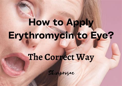 How to Apply Erythromycin to Eye? The Right Way (Guide) - Skinprosac