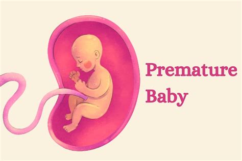 Premature Baby | Symptoms ,causes and Risk Factors | Medintu