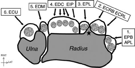 Dorsal extensor tendons of the wrist in their six (1 -6) separate ...