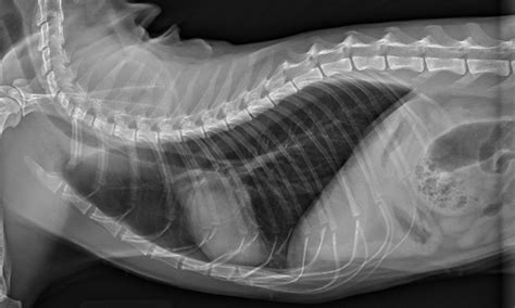 Top 5 Radiographic Variants | Clinician's Brief