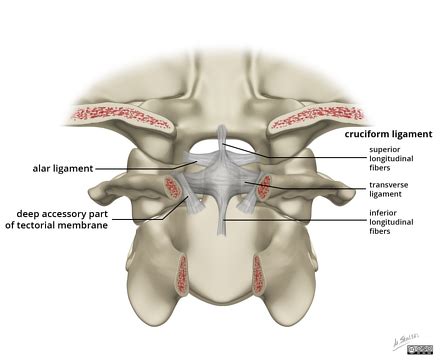 Apical ligament | Radiology Reference Article | Radiopaedia.org