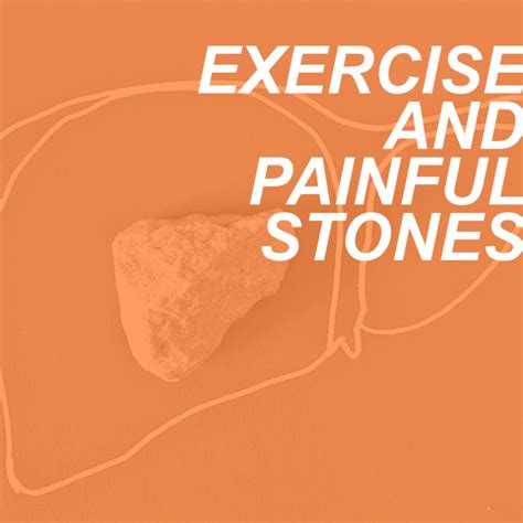 Kidney and Gall Stones: Can Exercise Help or Hinder?