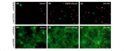 | BrdU staining and its cellular localization in astrocyte cultures ...