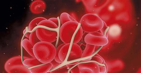 Who is thrombophiliac? | Thrombophiliac