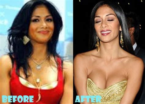 Nicole Scherzinger Plastic Surgery Before and After Pictures - Lovely ...