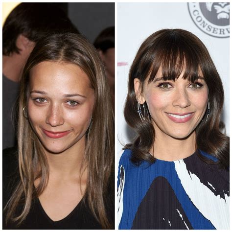 Did Rashida Jones Get Plastic Surgery? Our Experts Weigh In!