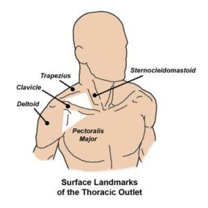 Anatomy of the Thoracic Outlet | Center for Thoracic Outlet Syndrome | Washington University in ...