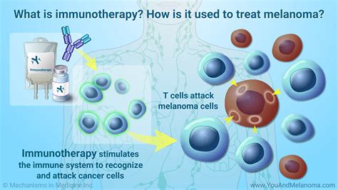 Slide Show - Treating Melanoma