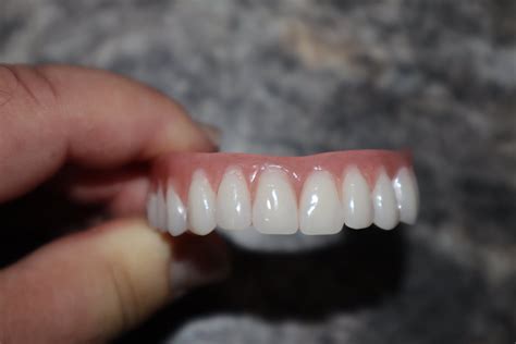 Upper Denture / Horseshoe Upper Dentures /the Denture is Real - Etsy Australia