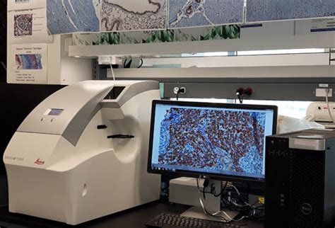 Leica Aperio AT Turbo digital pathology scanner - Research Institute of the McGill University ...