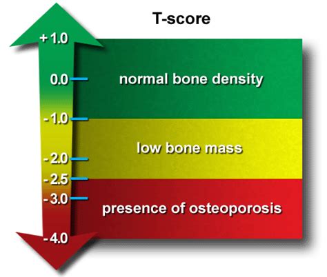 Osteoporosis | 🏥Singapore Orthopaedic & Sports Medicine