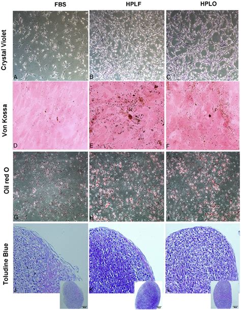 Mesenchymal stem cell morphology during expansion and differentiation.... | Download Scientific ...