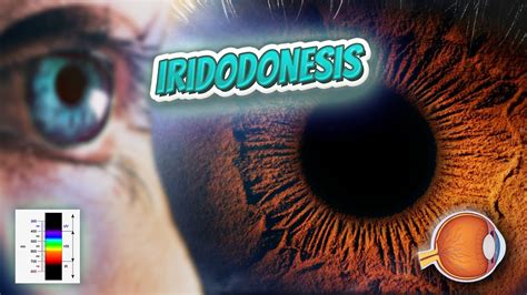 Iridodonesis (Your EYEBALLS) 👁️👁️💉😳💊🔊💯 - YouTube