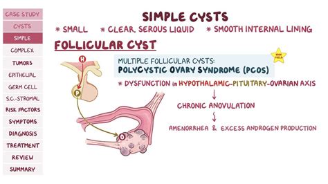 Ovarian cysts and tumors: Pathology review: Video | Osmosis