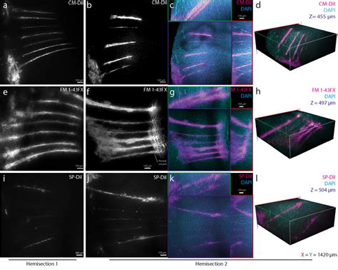 Comparing CLARITY-compatible lipophilic dyes for tracing and ...