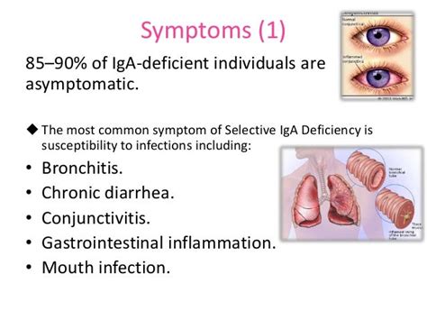 Selective igA deficiency