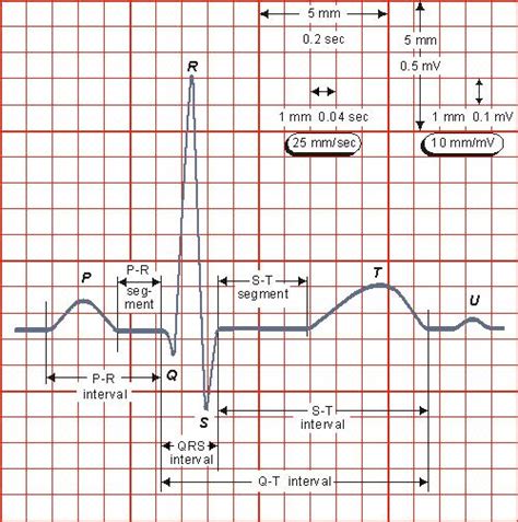 Electrocardiograph (ECG / EKG) – Sensors, Instrumentation & Electronics