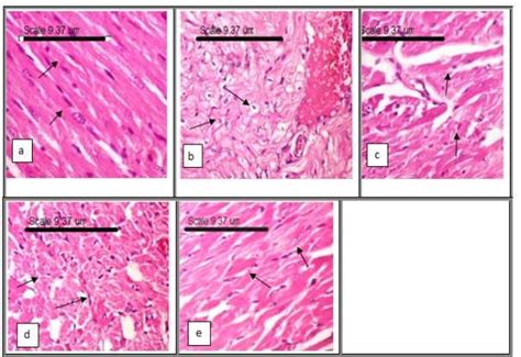 Cardiac muscle micrograph showing (a) Normal histological structure ...