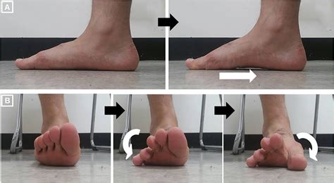 The effect of toe-tap exercise on abductor hallucis activity and medial longitudinal arch angle ...