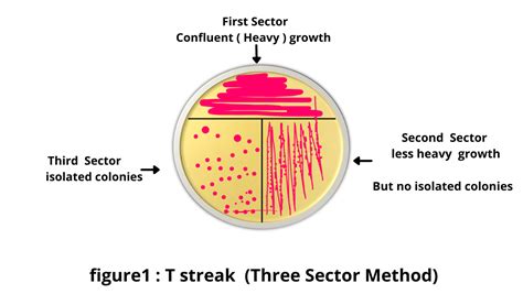 Streak Plate Method Principal and Types - RBR Life Science