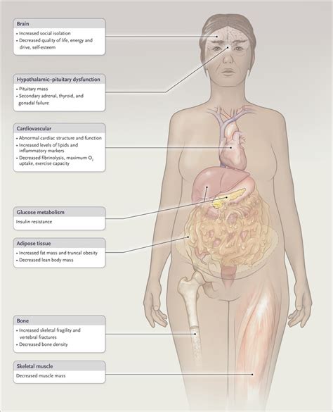 Pathogenesis and Diagnosis of Growth Hormone Deficiency in Adults | NEJM