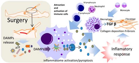 IJMS | Free Full-Text | Role of Damage-Associated Molecular Patterns ...