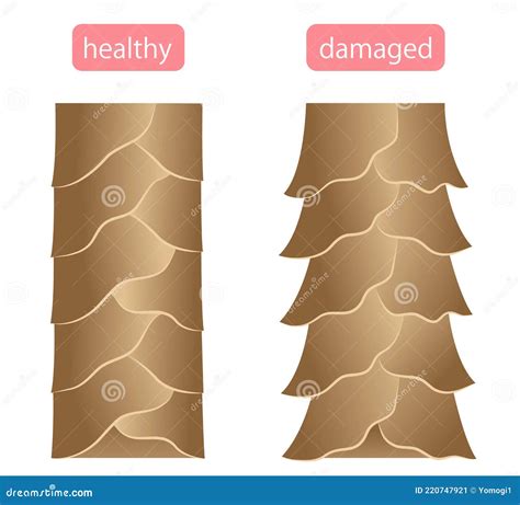 Damaged Cuticle Layer Cause Damaged Hair Cartoon Vector | CartoonDealer.com #68333967