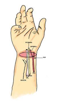 Radial Styloid Process