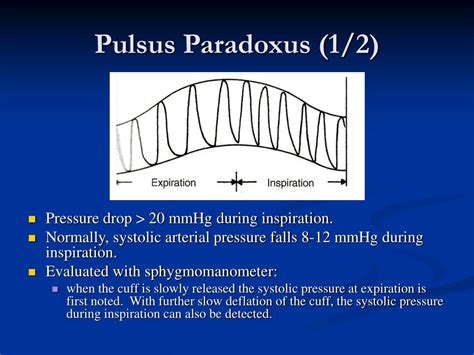 PPT - Pulse PowerPoint Presentation, free download - ID:485278