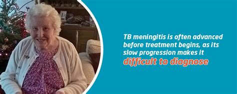 TB meningitis | Meningitis Now