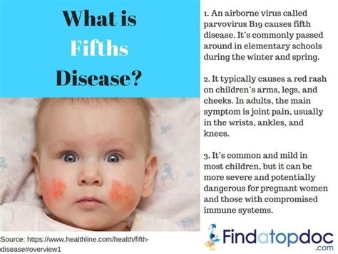 What is Fifths Disease: Causes and Treatment [Infographic]