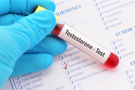 What are normal testosterone levels? Ages, males, females, and more