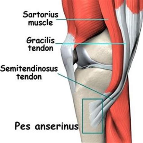 PES ANSERINE BURSITIS