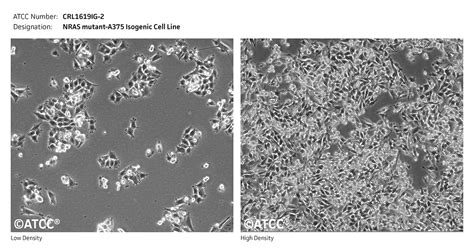 NRAS mutant-A375 Isogenic Cell Line - CRL-1619IG-2 | ATCC