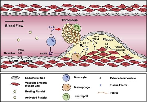 Tissue factor in atherosclerosis and atherothrombosis - Atherosclerosis