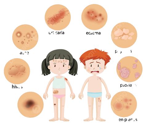Variations In Skin Conditions Between A Male And Female Human Vector, Children, Eps, Pathology ...