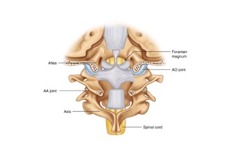 Pivot Joint Neck