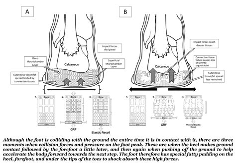 Fat Pad Atrophy - Insoles and Orthotics - Healthy Step