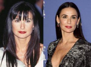 Demi Moore Before and After Plastic Surgery: Face, Boobs, Nose