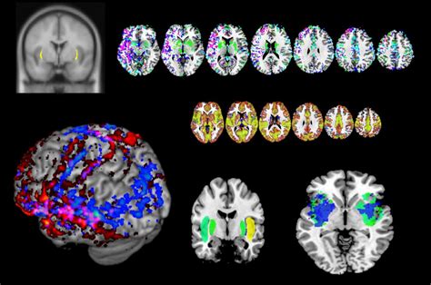 A brain area thought to impart consciousness instead behaves like an ...