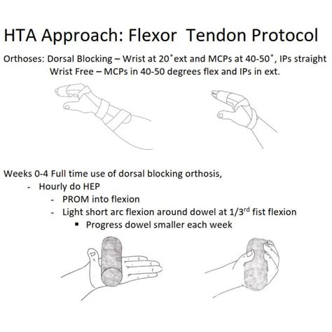 Flexor Tendon Treatment E-Book | Hand Therapy Academy