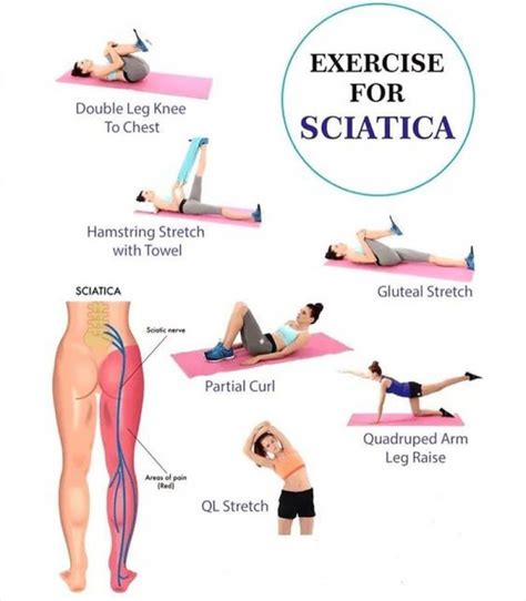 Sciatica - Merivale Osteopathy, Christchurch