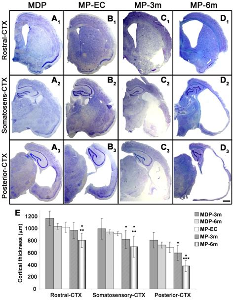 A–D) Low-power thionine-stained coronal sections from rostral (A1–D1 ...