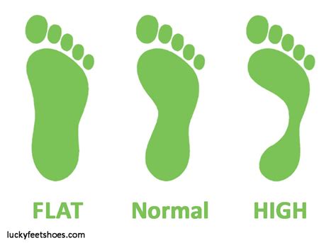 Flat Feet: Causes, Symptoms, Treatment & Prevention - Lucky Feet Shoes